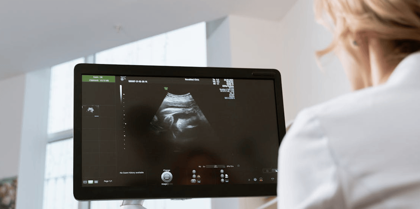 ultrasound