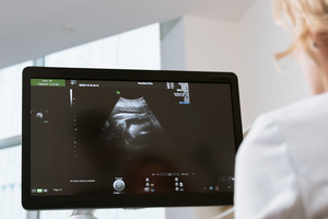 ultrasound